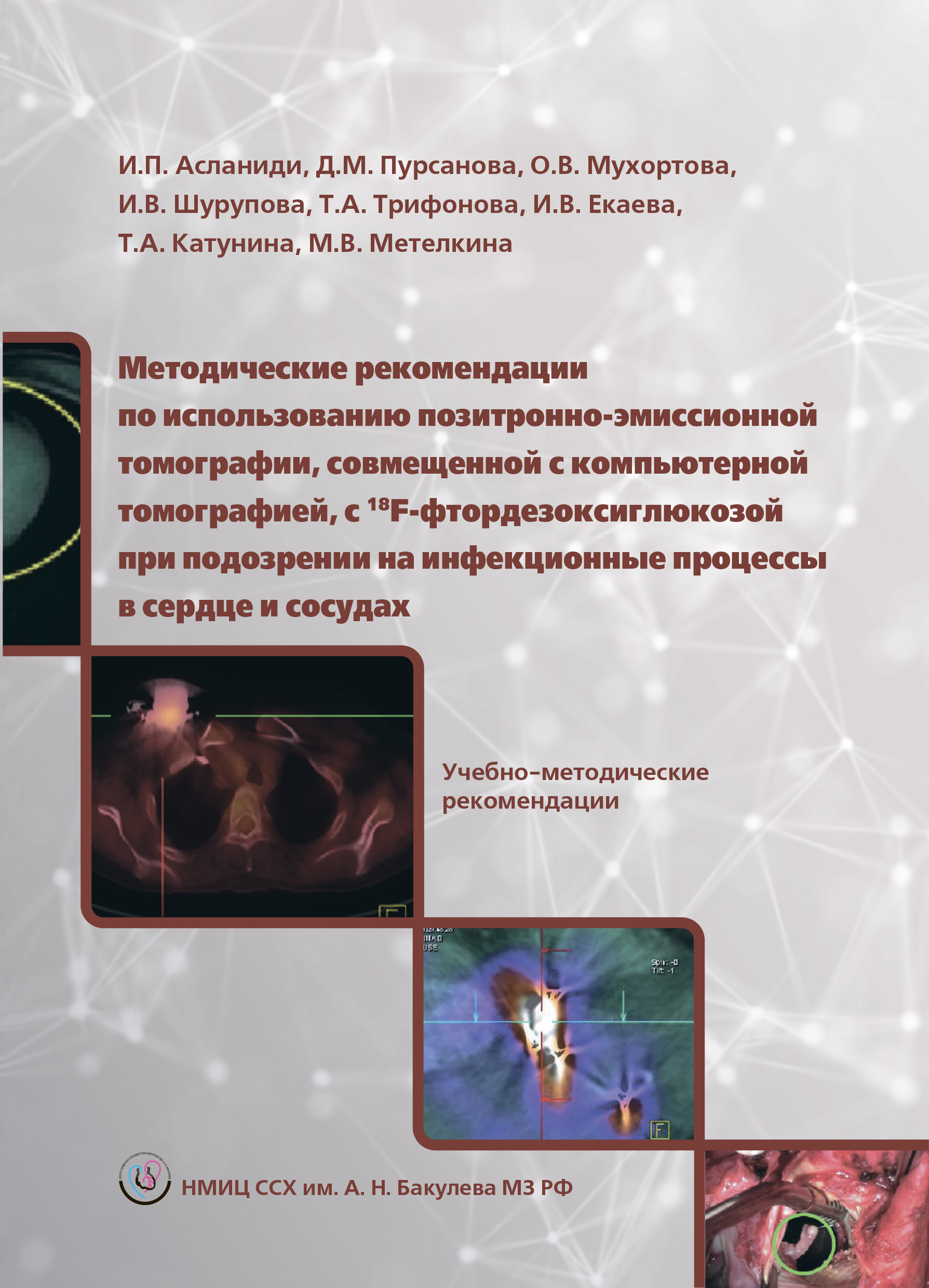 Методические рекомендации по использованию позитронно-эмиссионной томографии, совмещенной с компьютерной томографией, с 18F-фтордезоксиглюкозой при подозрении на инфекционные процессы в сердце и сосудах. Учебно-методические рекомендации. Методические рекомендации по использованию позитронно-эмиссионной томографии, совмещенной с компьютерной томографией, с 18F-фтордезоксиглюкозой при подозрении на инфекционные процессы в сердце и сосудах. Учебно-методические рекомендации.