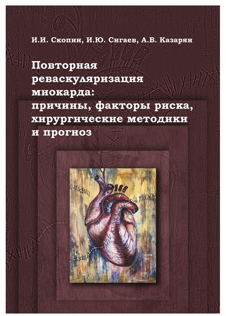 Повторная реваскуляризация миокарда: причины, факторы риска, хирургические методики и прогноз