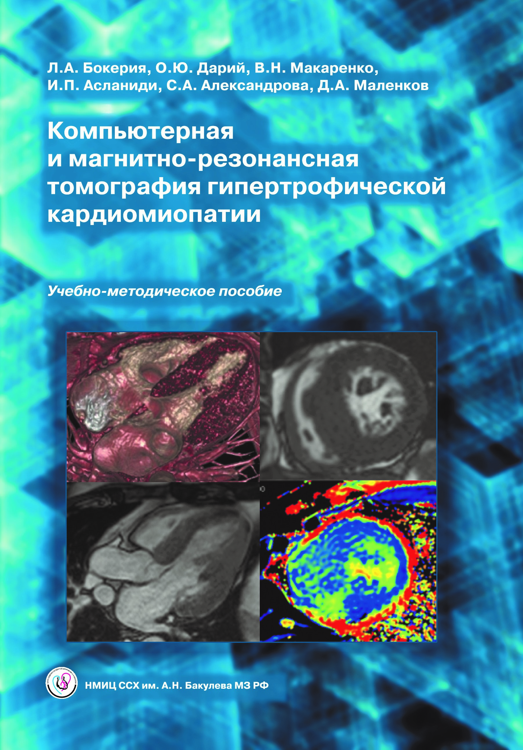 Компьютерная и магнитно-резонансная томография гипертрофической кардиомиопатии. Учебно-методическое пособие