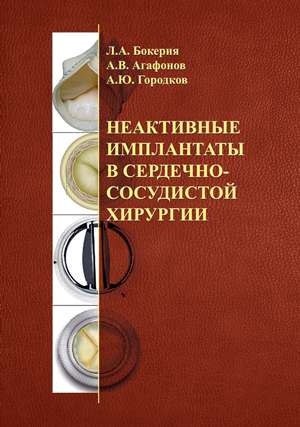 Неактивные имплантаты в сердечно- сосудистой хирургии Неактивные имплантаты в сердечно- сосудистой хирургии