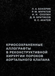 Криосохраненные аллографты в реконструктивной хирургии пороков аортального клапана Криосохраненные аллографты в реконструктивной хирургии пороков аортального клапана