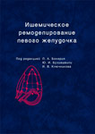 Ишемическое ремоделирование левого желудочка (методологические аспекты, вопросы диагностики и лечения)