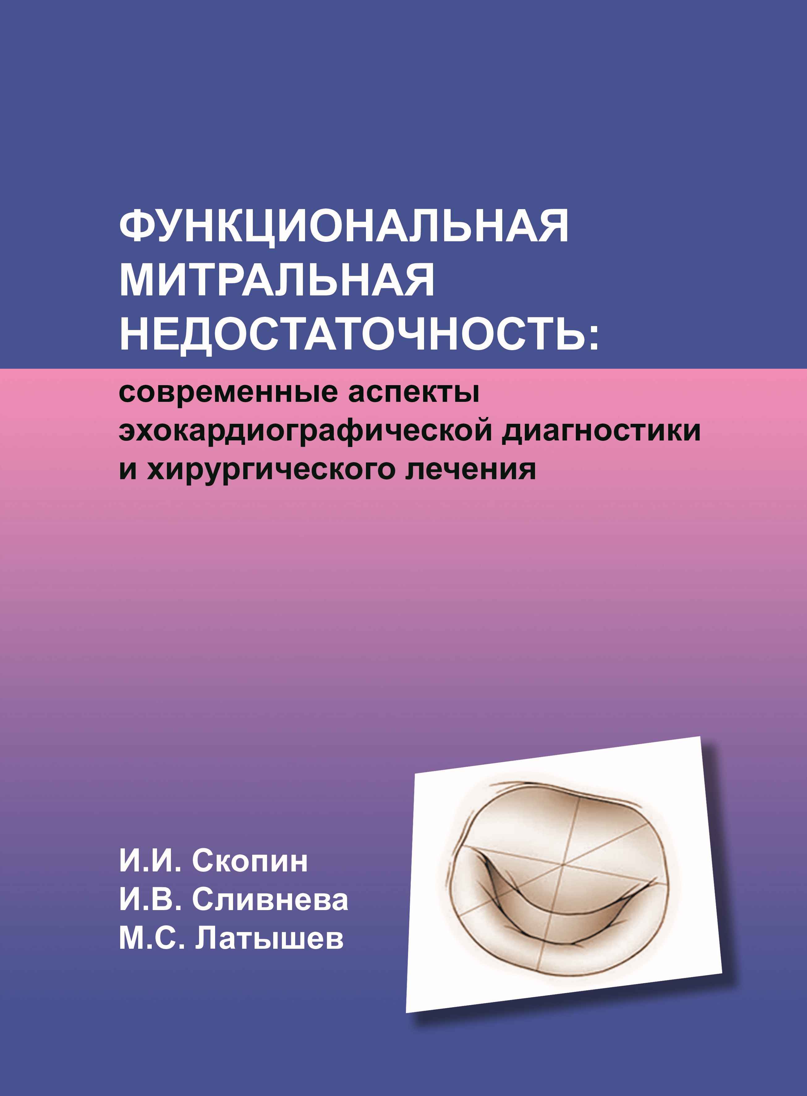 Функциональная митральная недостаточность: современные аспекты эхокардиографической диагностики и хирургического лечения Функциональная митральная недостаточность: современные аспекты эхокардиографической диагностики и хирургического лечения