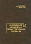Минимально инвазивная реваскуляризация миокарда