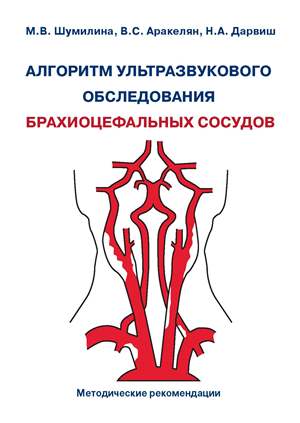 Алгоритм ультразвукового обследования брахиоцефальных сосудов. Методические рекомендации Алгоритм ультразвукового обследования брахиоцефальных сосудов. Методические рекомендации