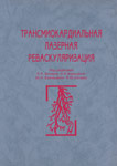 Трансмиокардиальная лазерная реваскуляризация