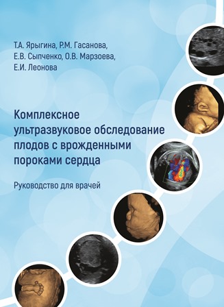 Комплексное ультразвуковое обследование плодов с врожденными пороками сердца. Руководство для врачей. Книга закончилась. Готовится допечатка