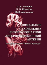 Аномальное отхождение левой коронарной артерии от лёгочной артерии (синдром Бланда-Уайта-Гарланда)