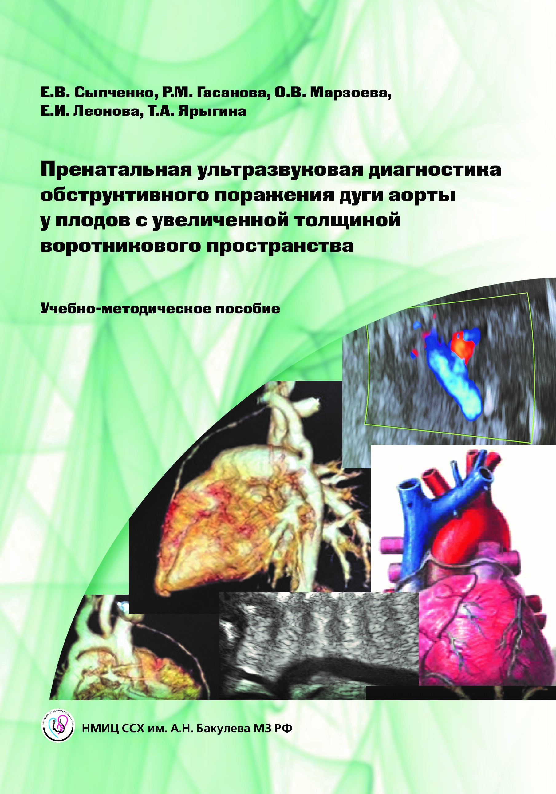 Пренатальная ультразвуковая диагностика обструктивного поражения дуги аорты у плодов с увеличенной толщиной воротникового пространства. Учебно-методическое пособие.