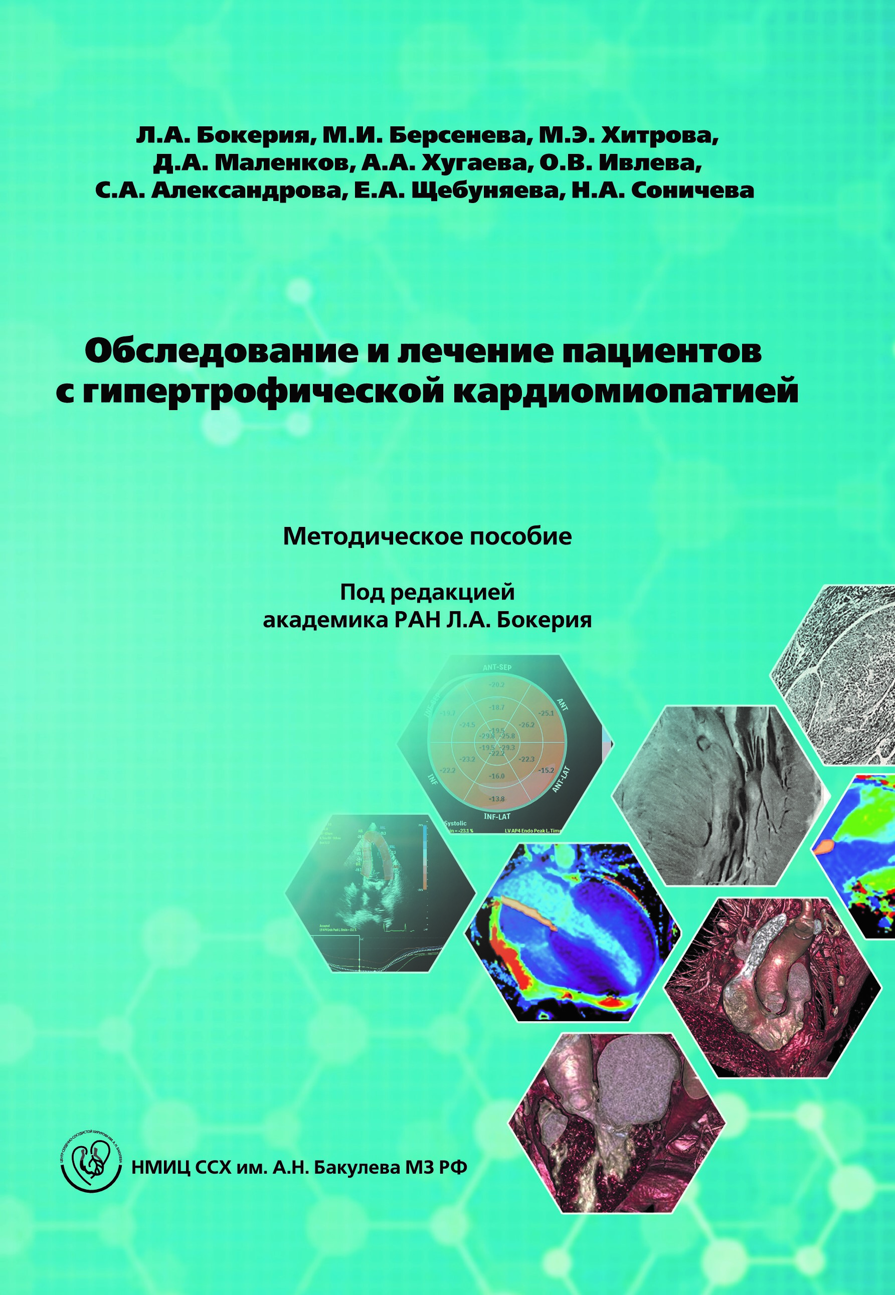 Обследование и лечение пациентов с гипертрофической кардиомиопатией. Методическое пособие. Под редакцией академика РАН