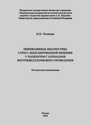 Неинвазивная диагностика стресс-индуцированной ишемии у пациентов с блокадами внутрижелудочкового проведения: Методические рекомендации