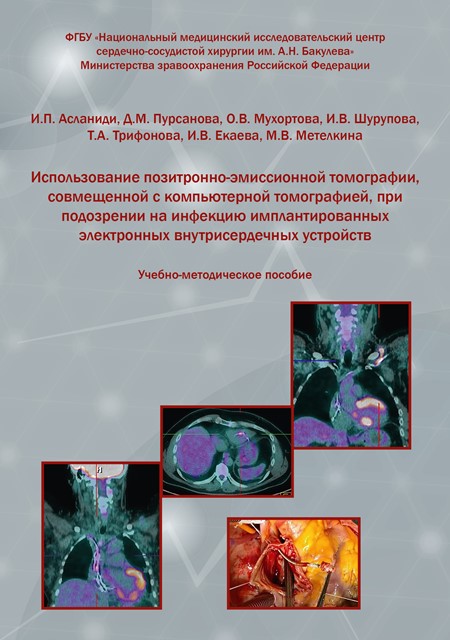 Использование позитронно-эмиссионной томографии, совмещенной с компьютерной томографией, при подозрении на инфекцию имплантированных электронных внутрисердечных устройств: Учебно-методическое пособие