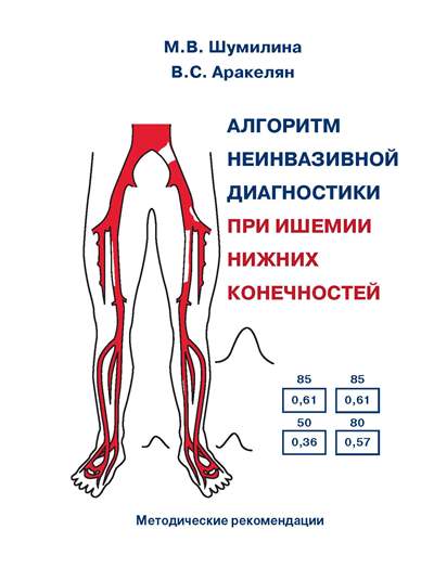 Алгоритм неинвазивной диагностики при ишемии нижних конечностей. Методические рекомендации Алгоритм неинвазивной диагностики при ишемии нижних конечностей. Методические рекомендации