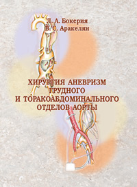 Хирургия аневризм грудного и торакоабдоминального отделов аорты: руководство для врачей