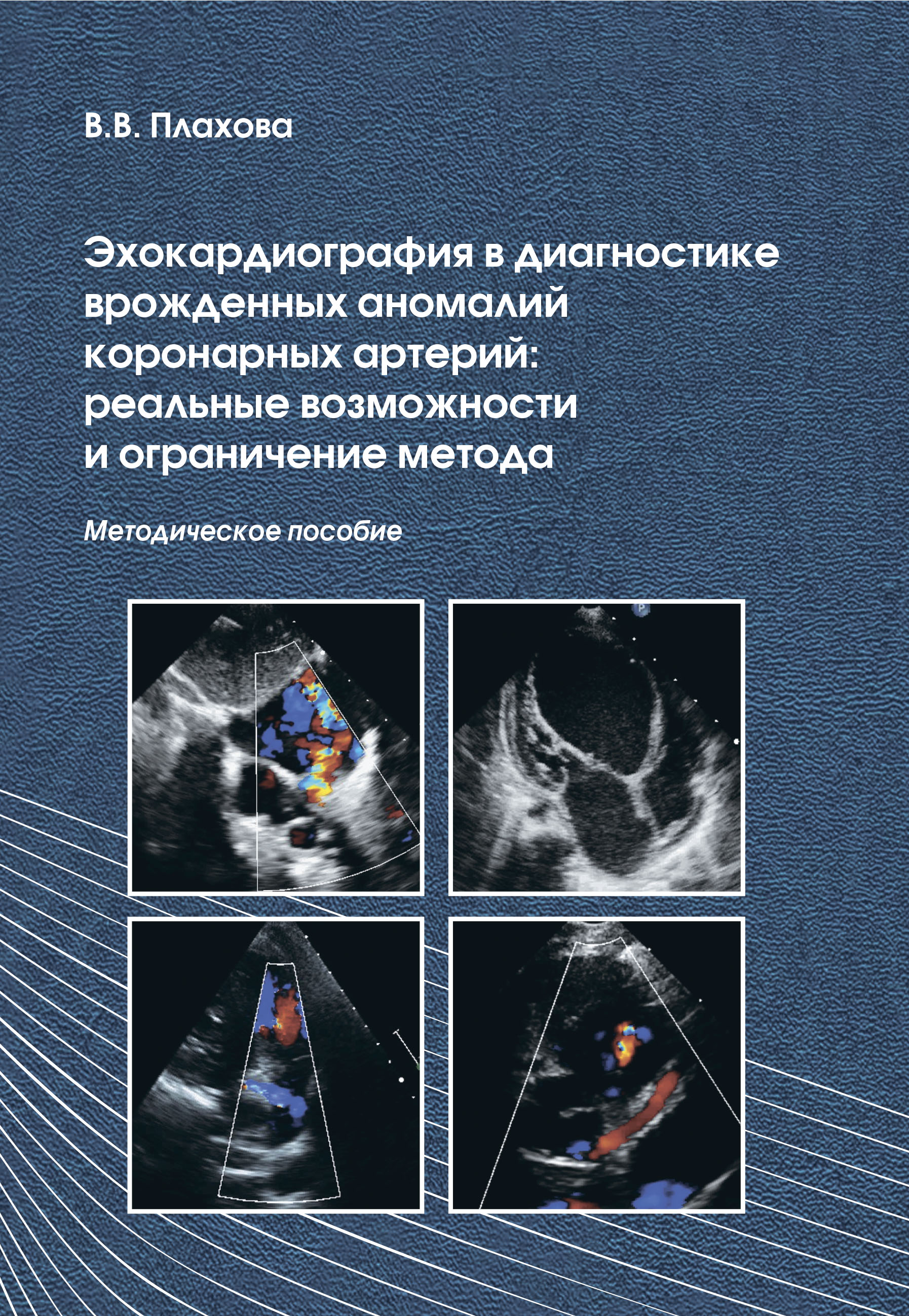 Эхокардиография в диагностике врожденных аномалий коронарных артерий: реальные возможности и ограничение метода. Методическое пособие Эхокардиография в диагностике врожденных аномалий коронарных артерий: реальные возможности и ограничение метода. Методическое пособие